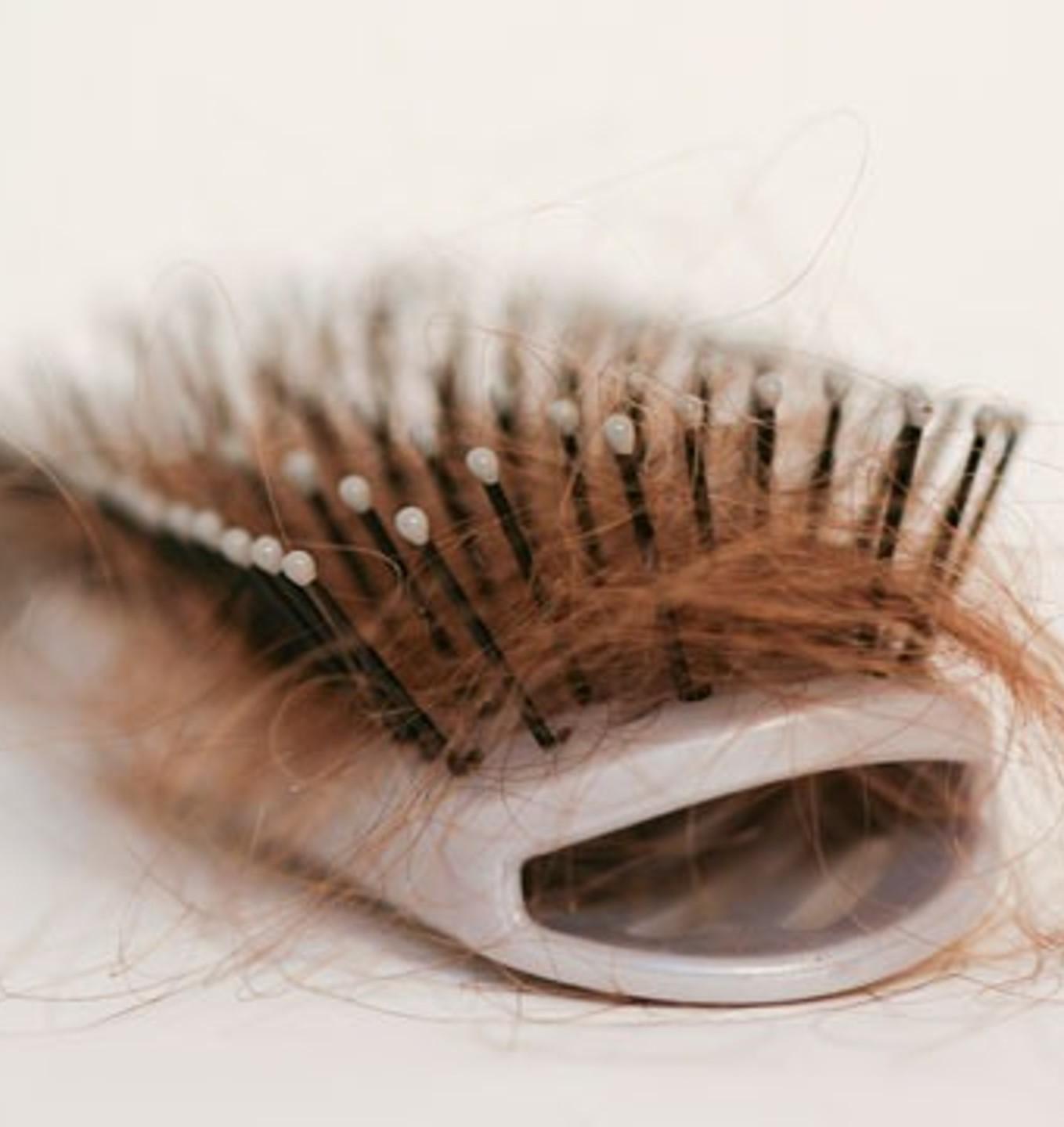 Hair loss - a sensitive topic | Mibelle Biochemistry